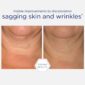 30156_neostrata_triple_firming_neck_cream_v6.jpg
