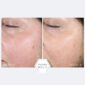 30273_neostrata_restore_pha_renewal_pads_v5.jpg