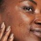 30162_neostrata_dark_spot_corrector_v4.jpg