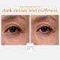 30119_neostrata_brightening_eye_cream_v5.jpg