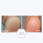30154_neostrata_problem_dry_skin_cream_v6_.jpg