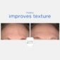 30134_neo_smooth_surface_glycolic_peel_v6.jpg