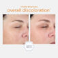 30161_neostrata_ENLIGHTEN_ILLUMINATING_SERUM_V5.jpg