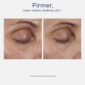 30305_neostrata_intensive_eye_therapy_v9.jpg