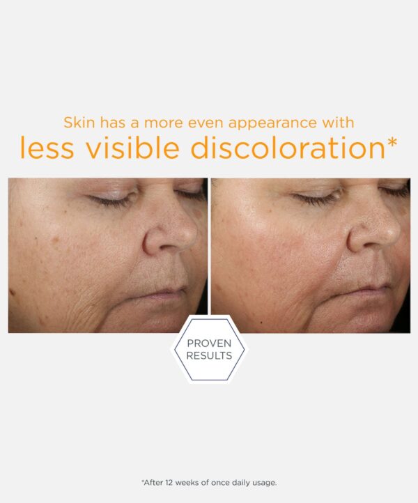 30251_neo_15_vitamin_c_serum_v5.jpg Bilden representerar resultatet av avändning av neostrata produkt.