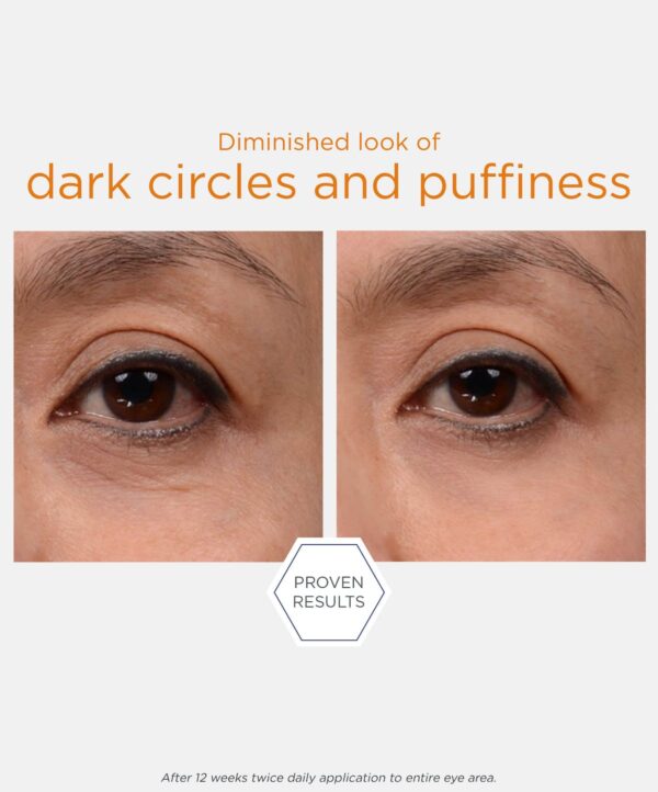 30119_neostrata_brightening_eye_cream_v5.jpg Bilden visar två bilder som representerar resultat av att använda en neostrata produkt.