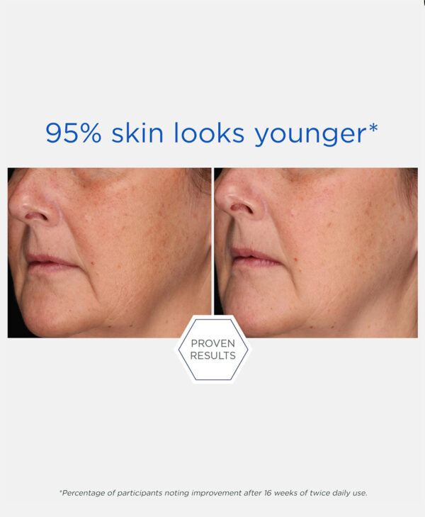 30303_neo_rebound_sculpting_cream_v5.jpg 30303_neo_rebound_sculpting_cream_v5.jpg