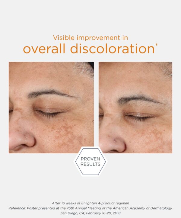 30160_neostrata_pigment_controller_v5.jpg Bilden representerar resultatet av avändning av neostrata produkt.