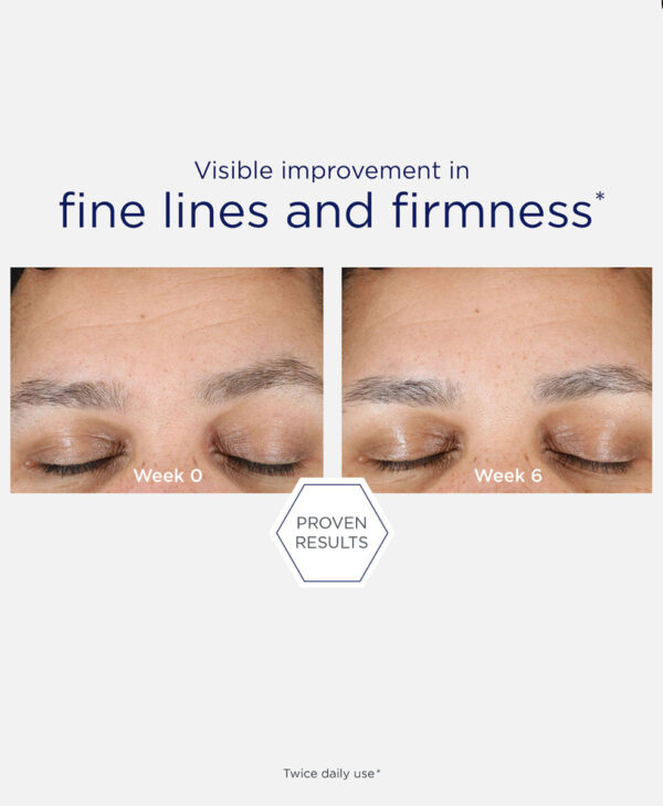 30268_neostrata_skin_active_hyaluronic_luminous_lift_v5.jpg Bilden representerar resultatet av avändning av neostrata produkt.