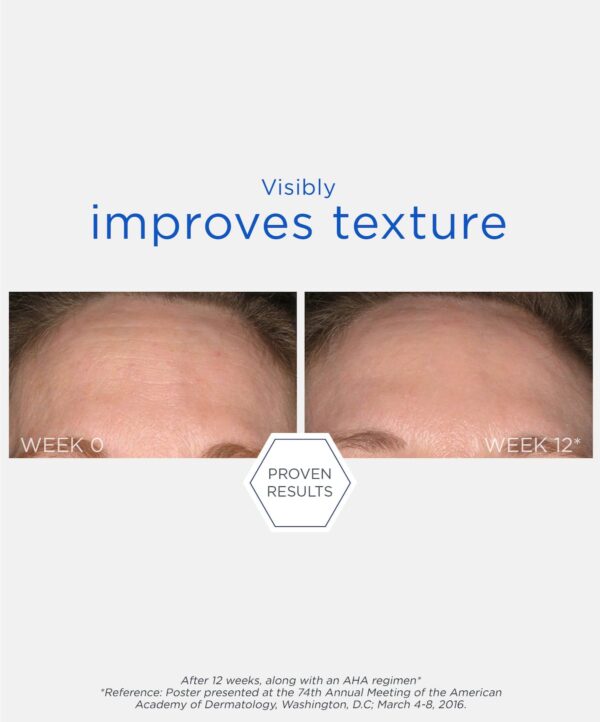 30134_neo_smooth_surface_glycolic_peel_v6.jpg Bilden representerar resultatet av att använda neostrata produkter.