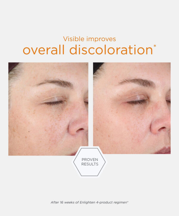 30161_neostrata_ENLIGHTEN_ILLUMINATING_SERUM_V5.jpg Bilden representerar resultatet av avändning av neostrata produkt.