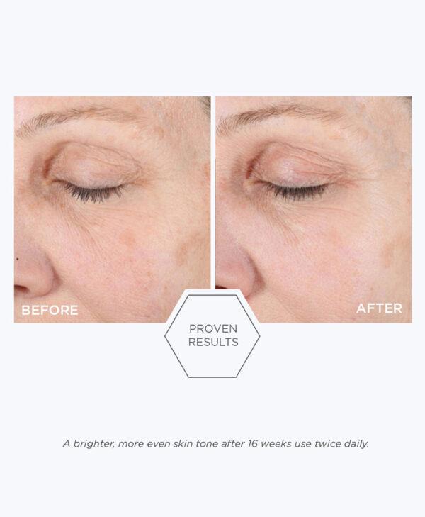 30123_neostrata_ultra_brightening_cleanser_v5.jpg Bilden presenterar resultatet efter att ha använt en neostrata produkt.