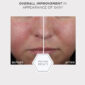 30324_Mandelic_Clarifying_Hydragel_v6.jpg