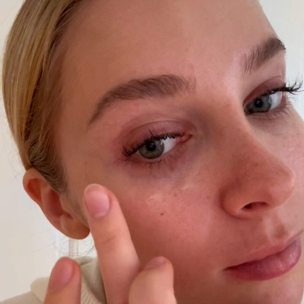 Bild på ung tjej som applicerar en ögonkräm för att minska fina linjer